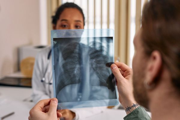 Découverte des défis inattendus en pneumologie à Genève